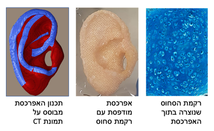 3D_printed_prosthetic_ear_scaffold.png